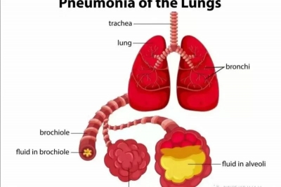 世界卫生组织表示中国肺炎的瘟疫没有蔓延