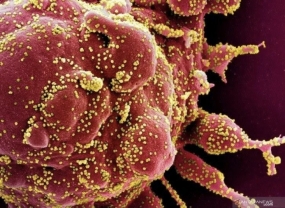 La France détecte le premier cas de mutation covid-19 sud-africaine