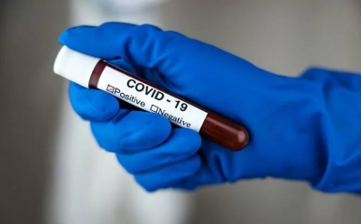 Tangan seorang perawat dalam sarung tangan memegang tabung reaksi dengan tulisan COVID 19 dengan tes darah positif untuk virus corona baru yang menyebar dengan cepat. ANTARA/Shutterstock/pri.