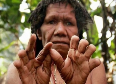 PAPUA島のダニ部族の指と耳ををカットするのは、深い悲しみの一形態